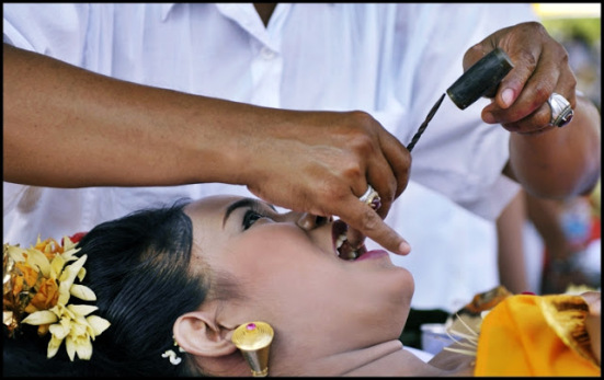 bali tooth filing ceremony
